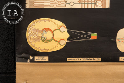 1959 Winslow Heath And Hygiene Series - W11: The Eye