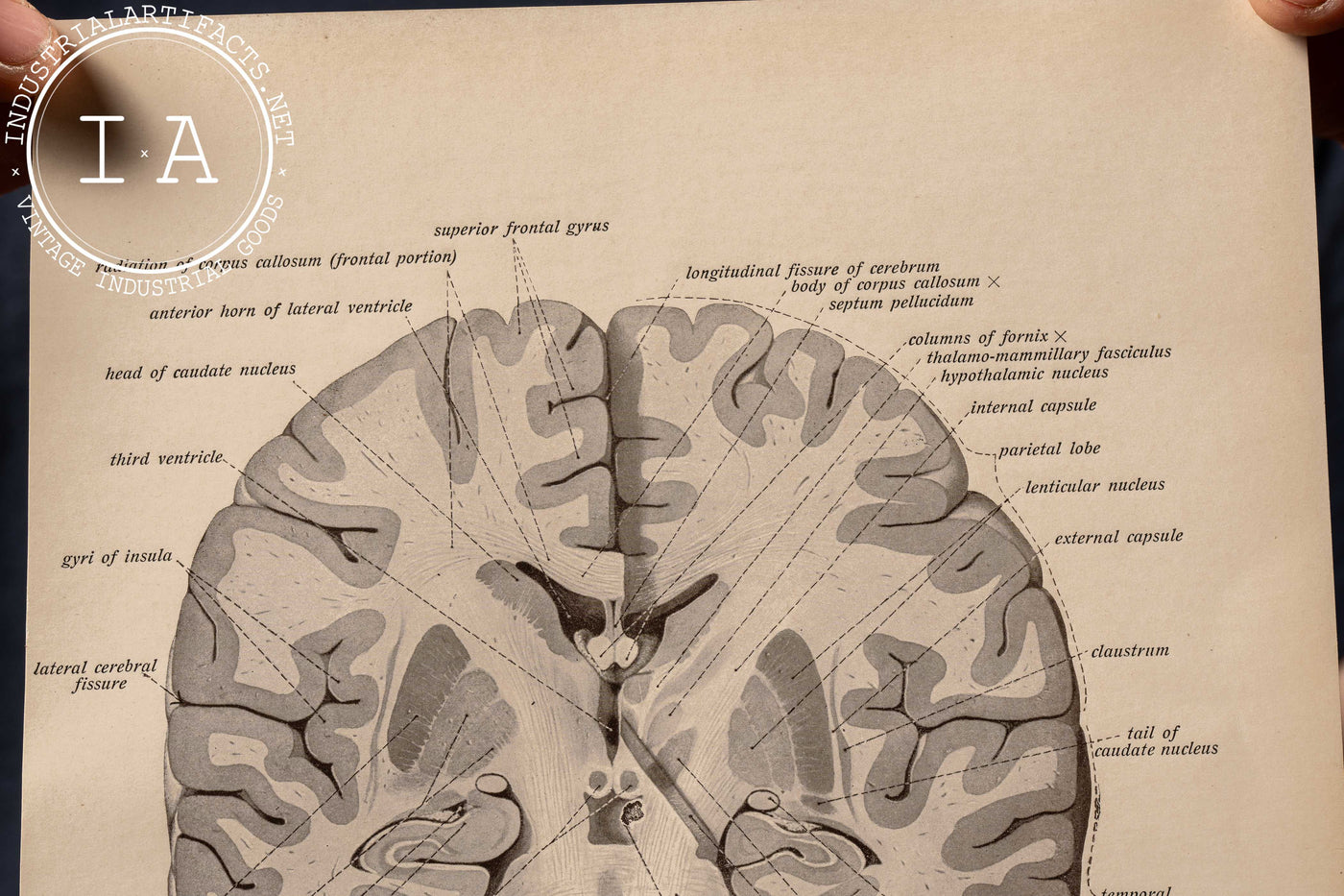 Antique Print Brain Diagram