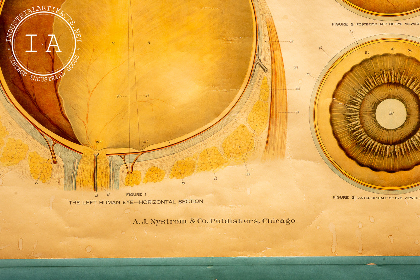 c. 1918 American Frohse Anatomical Chart