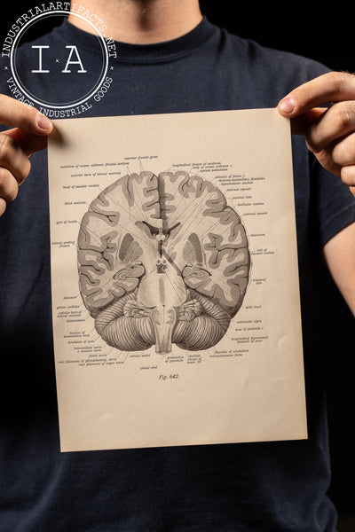 Antique Print Brain Diagram